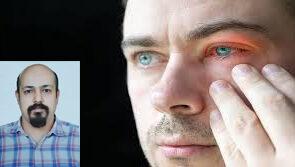 درمان خشکی چشم