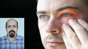 درمان خشکی چشم